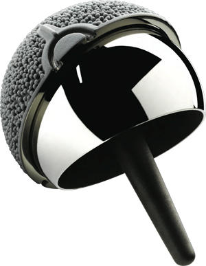 allegato 2 protesi anca