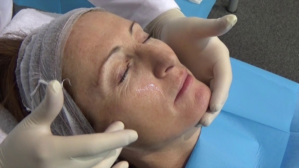 PQ age revolution nuovo peeling effetto anti-age e non solo
