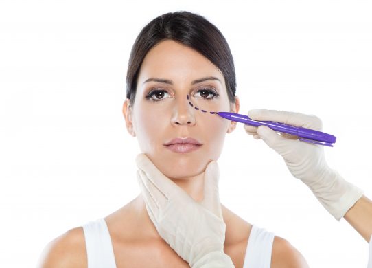 5 domande sulla blefaroplastica il trattamento per uno sguardo nuovo, più giovane e vivace