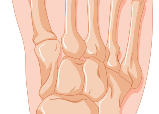 Alluce valgo sintomi rimedi interventi