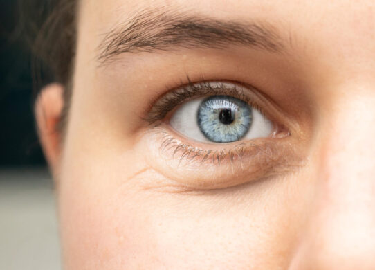 Blefaroplastica non chirurgica con Plexr & Felc