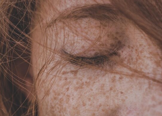 Blefaroplastica non chirurgica con laser CO2 frazionato