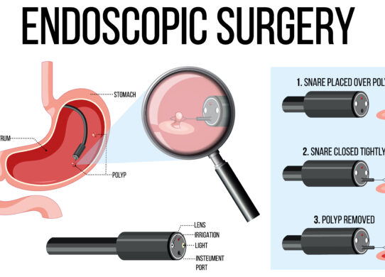 Calo di peso con tecniche endoscopiche Mininvasività e sicurezza per il paziente