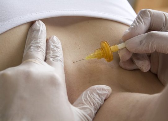 Carbossiterapia una tecnica efficace per rimodellare il corpo