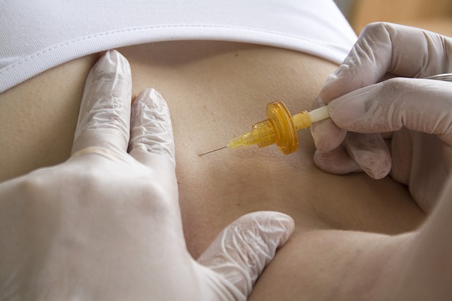 Carbossiterapia: una tecnica efficace per rimodellare il corpo