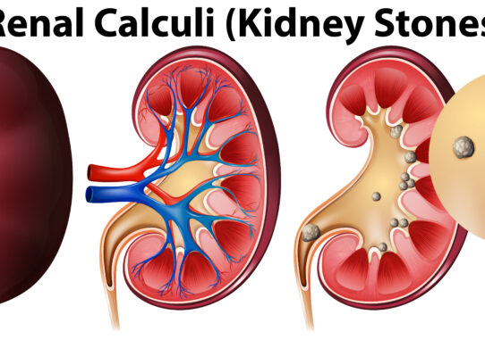 Colecisti e Calcolosi Intervento Laparoscopico e Trattamento