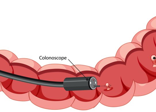 Colon irritabile cause e soluzioni