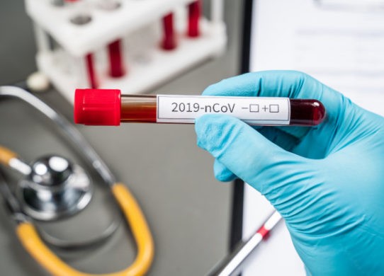 Coronavirus e Remdesivir speranza concreta