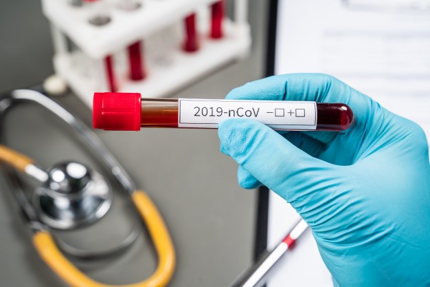 Coronavirus e Remdesivir: speranza concreta