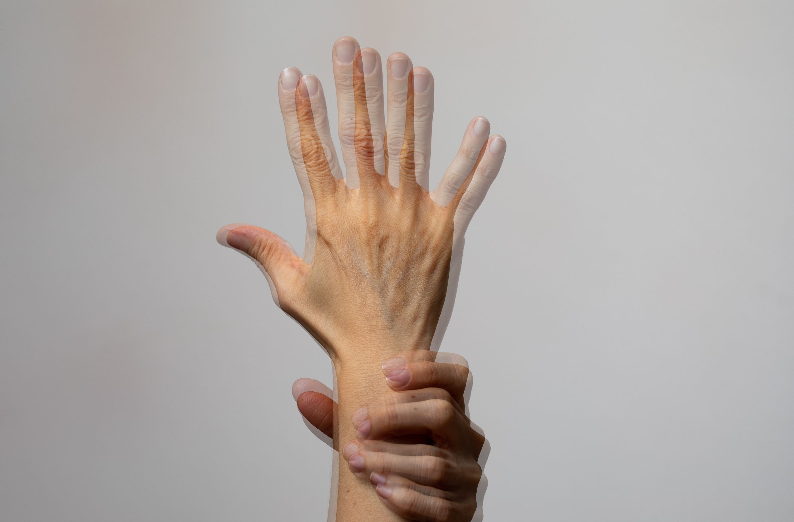 Cos’è la diplopia?