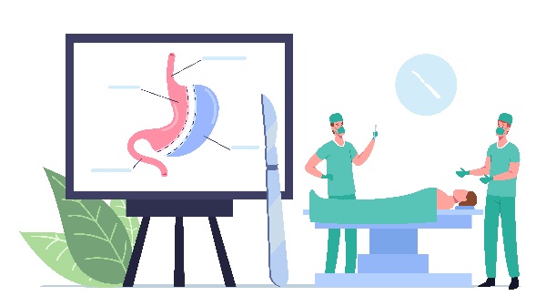 Endoscopia Bariatrica Una Prospettiva Innovativa per la Gestione dell'Obesità