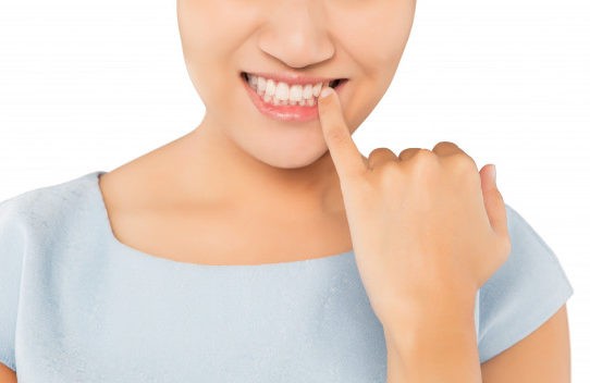 Gengivite e parodontite come evitarle