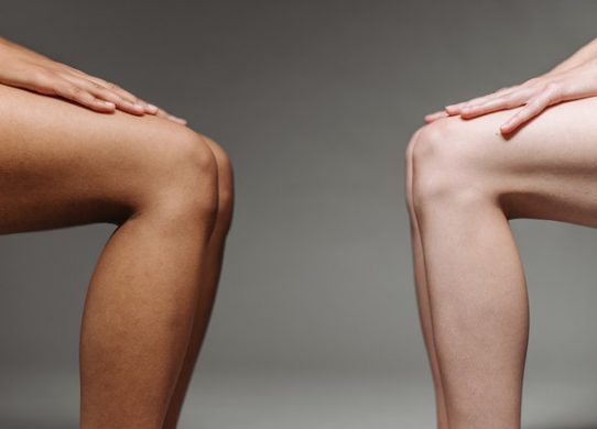 Gli edemi degli arti inferiori concetti pratici