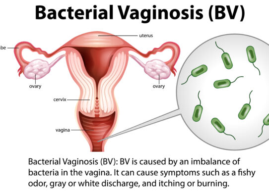 Il vaginismo sintomi e terapie