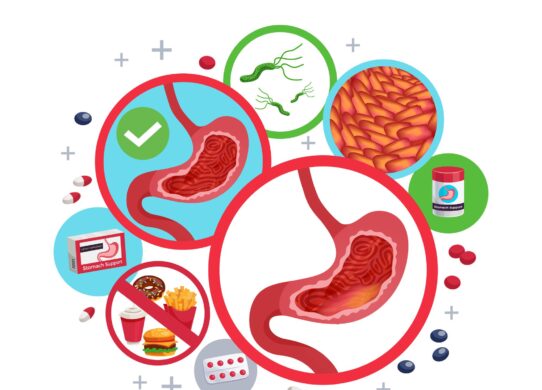 Le 4 forme di gastrite più comuni