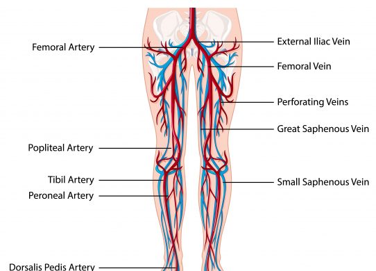 L’arteriopatia obliterante