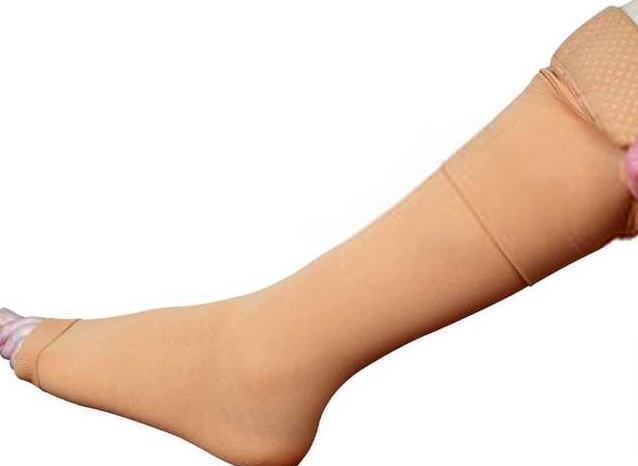 L’elastocompressione: cos’è e quando serve