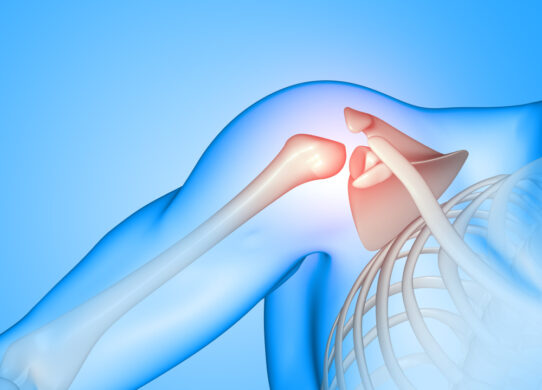 Lesione della cuffia dei rotatori della spalla cause sintomi e trattamenti efficaci