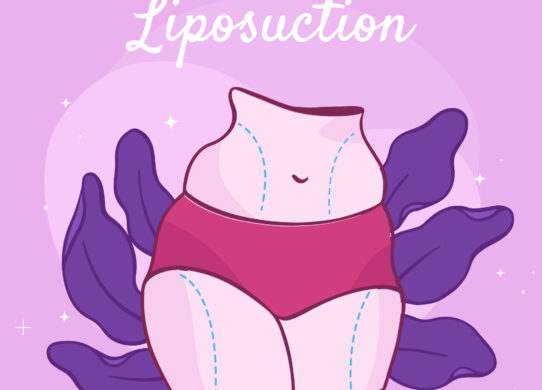 Liposuzione Chirurgica e Non Chirurgica Differenze e Benefici