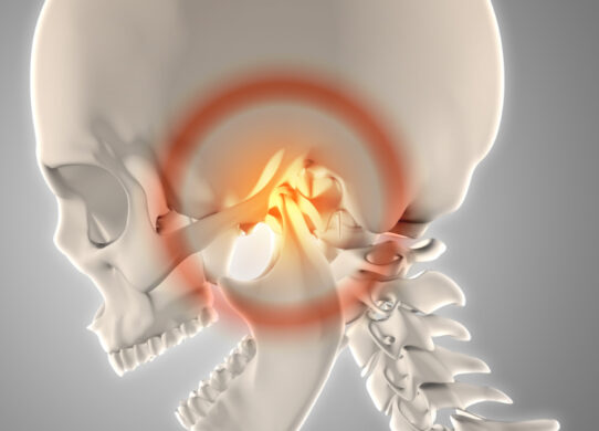 Lussazione del disco dell’articolazione temporo-mandibolare: come gestirla