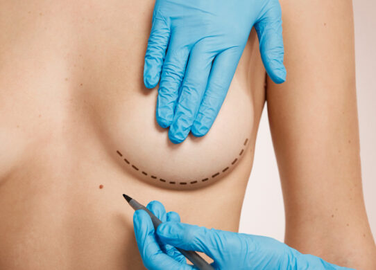 Mastopessi e mastoplastica riduttiva differenze e indicazioni