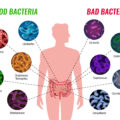 Microbiota intestinale mal di schiena e stanchezza cronica le correlazioni nascoste