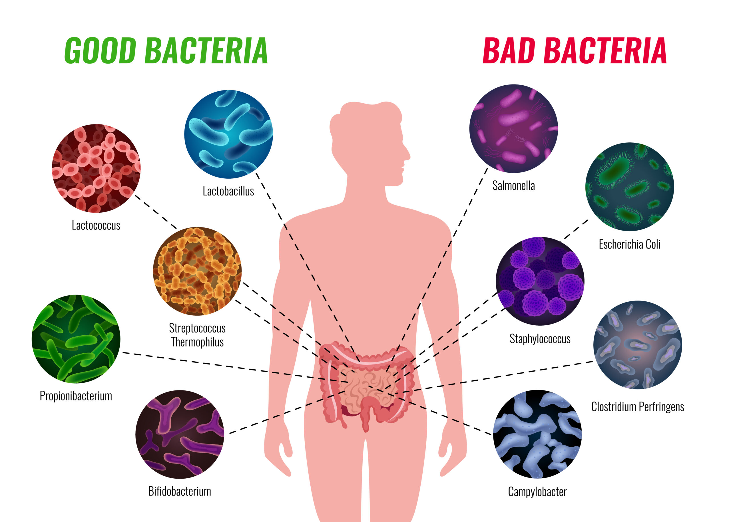 Microbiota intestinale mal di schiena e stanchezza cronica le correlazioni nascoste