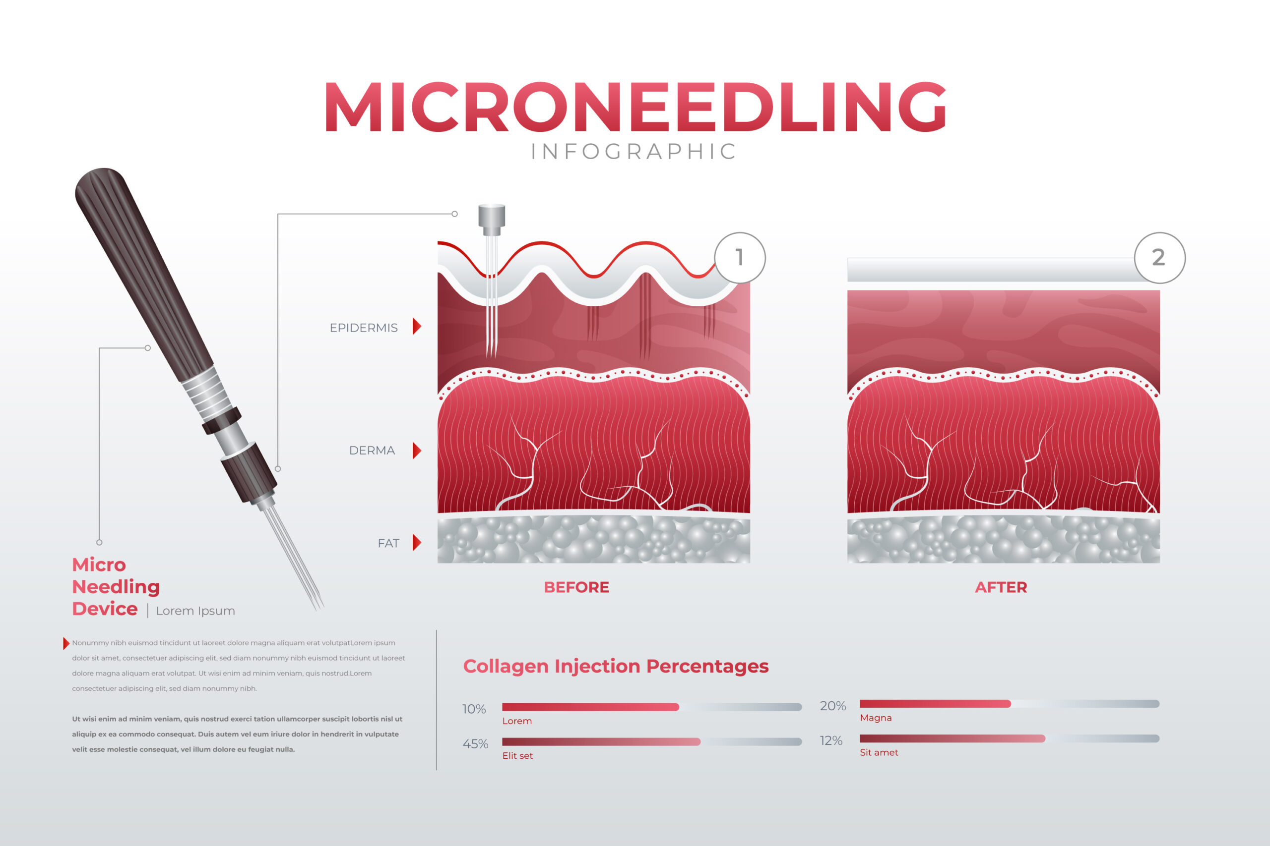 Microneedling non solo ringiovanimento del viso