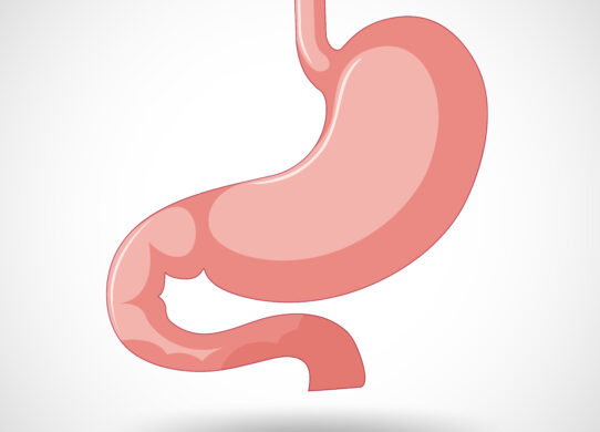 Palloncino gastrico cos'è a cosa serve quando è necessario