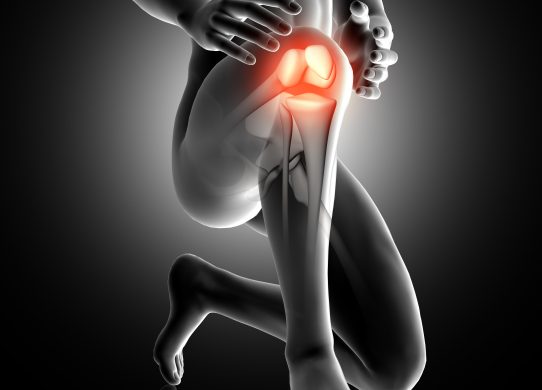 Protesi del ginocchio quando è necessaria