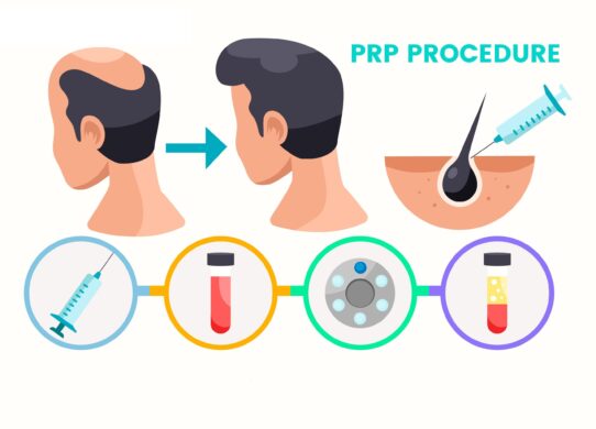 Prp capelli di cosa si tratta e come si articola tale trattamento