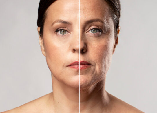 Radiofrequenza per un corpo rimodellato