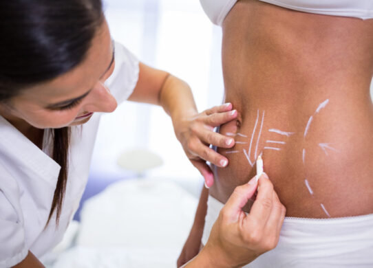 Rimodellamento del Corpo con Metodiche Non Invasive Una Rivoluzione Estetica