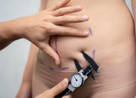 Total Sculpt in Estetica Una Guida Completa alla Procedura