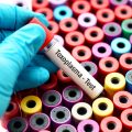 Toxoplasma,Test