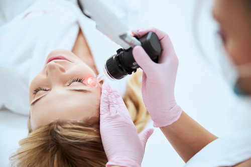 Trattamento con laser CO2 cosa aspettarsi