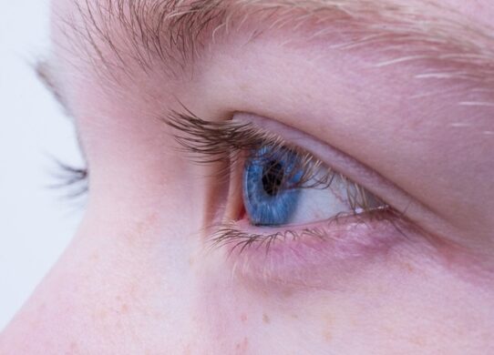 Xantelasma innocui inestetismi