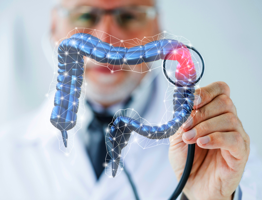 Diverticoli: Cause, Sintomi e Intervento in Laparoscopia