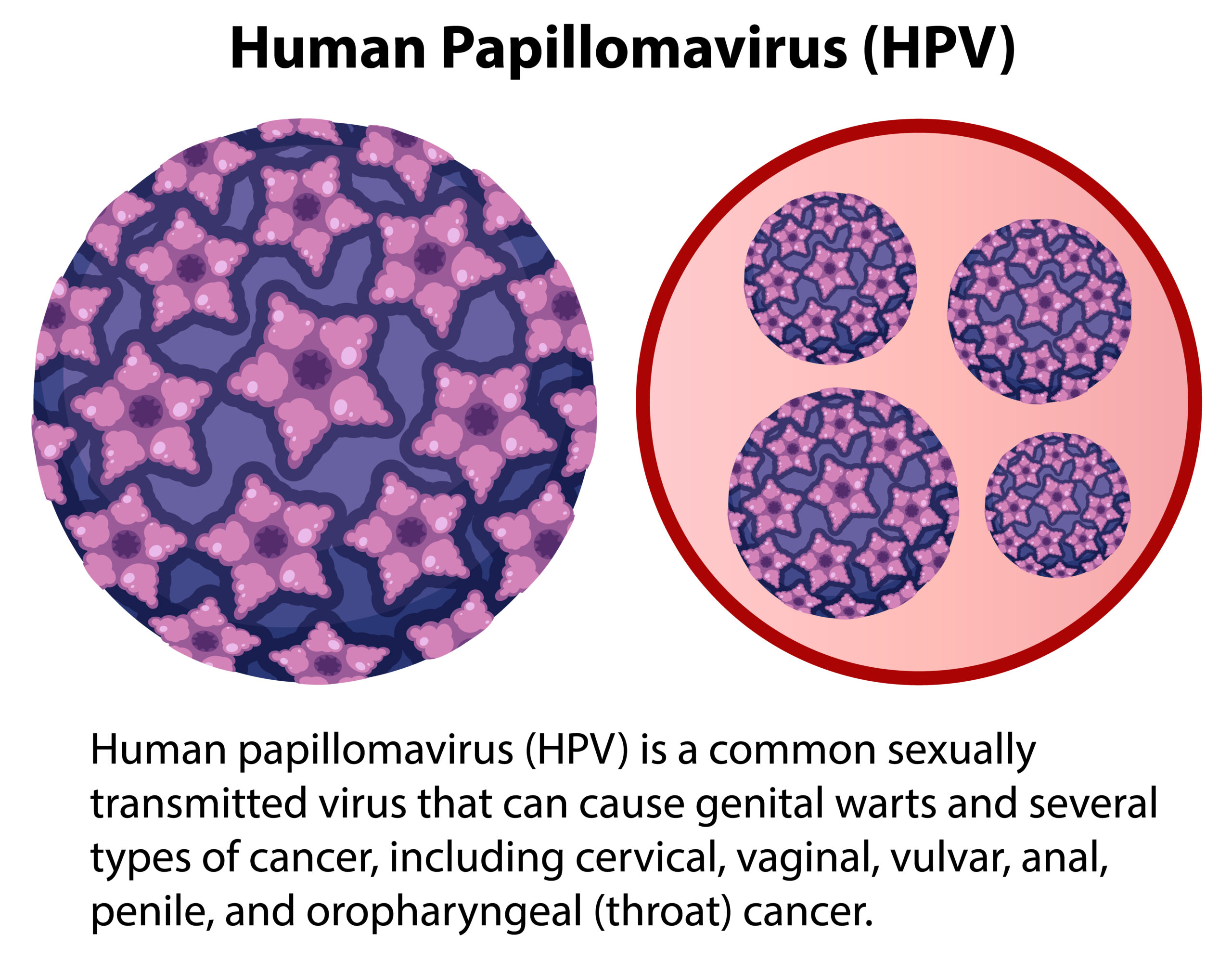 HPV e Vaccino HPV: tutto quello che devi sapere