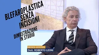 leoni_blefaroplastica