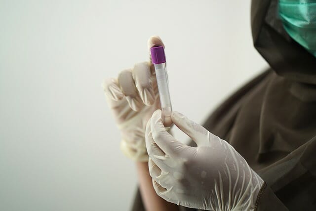 Meningite: esame del sangue predice le complicanze